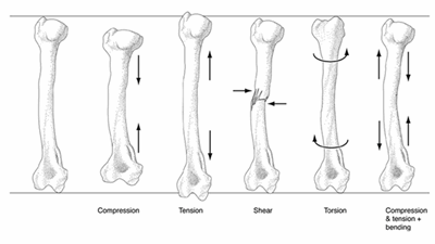 Compression, tension, shear, torsion on bones