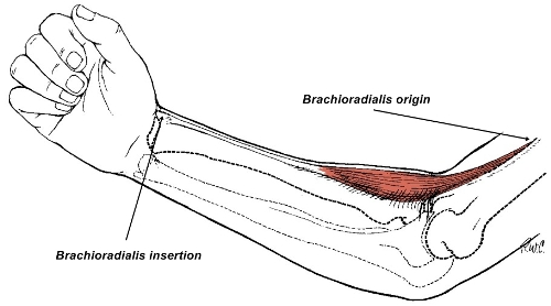 brachioradialis muscle
